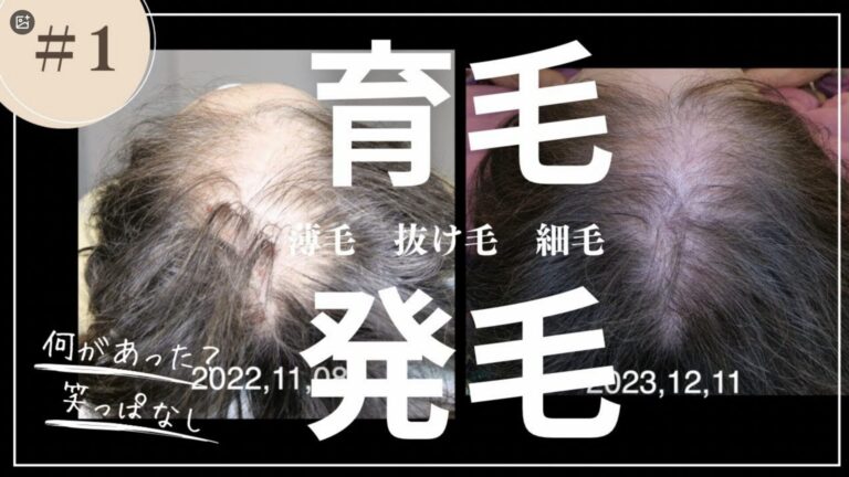 薄毛
